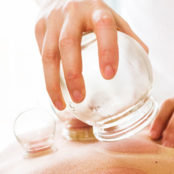 Cupping therapy being performed on a patient