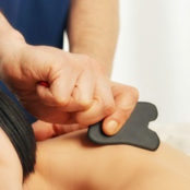 Gua Sha massage being performed on a patient